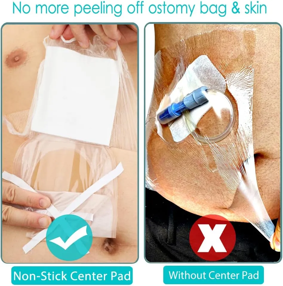 Waterproof Ostomy Bag Shower Cover with Non Sticky Pad Colostomy Ilostomy Urlostomy Pouch Shower Guard Shield